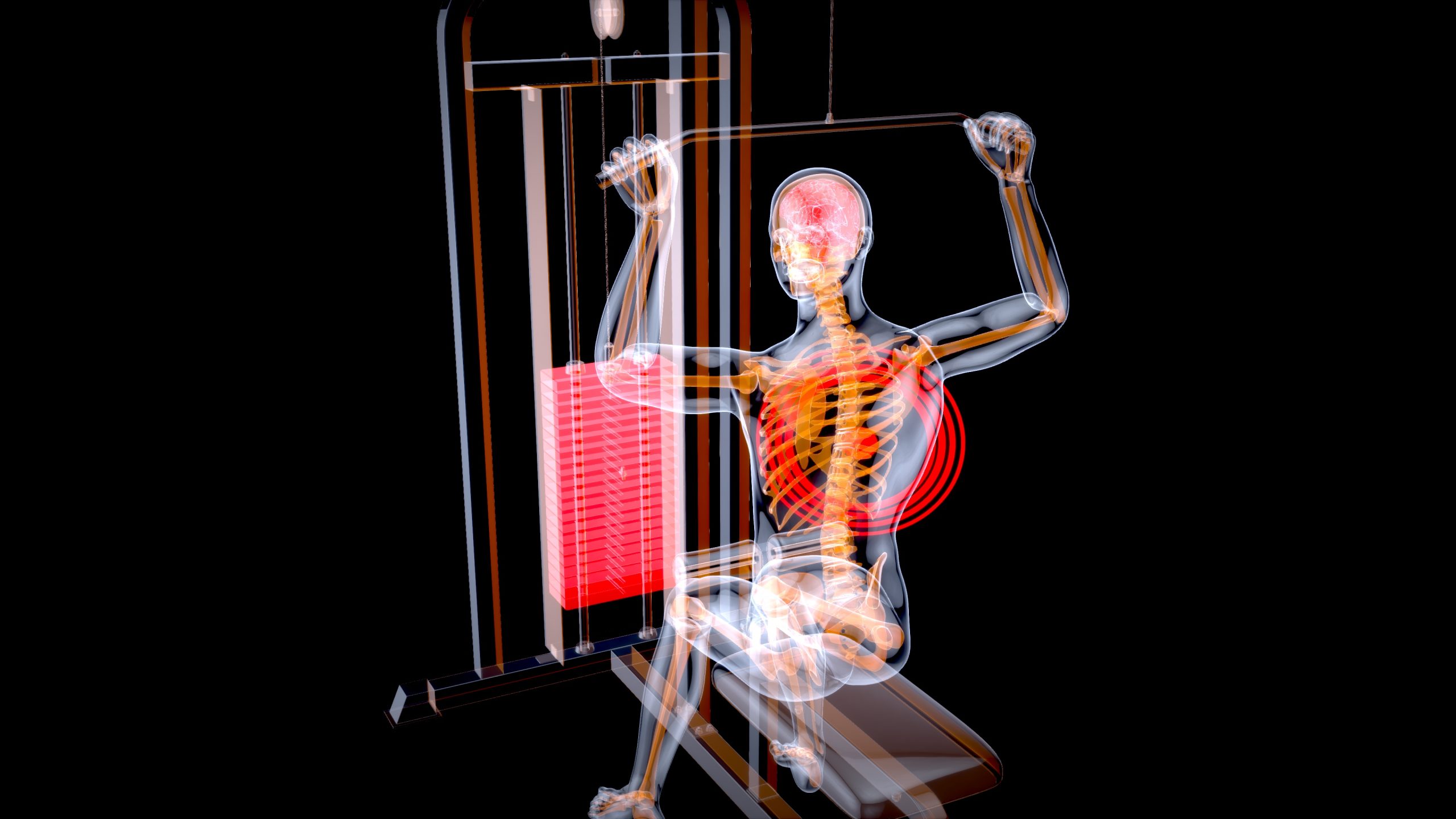 Spinal Fusion